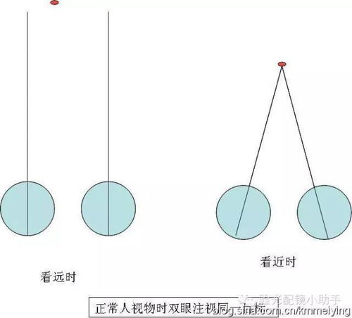 眼位异常是什么意思啊，眼位检查的方法及判断